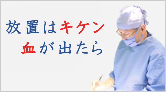 痔の放置は危険